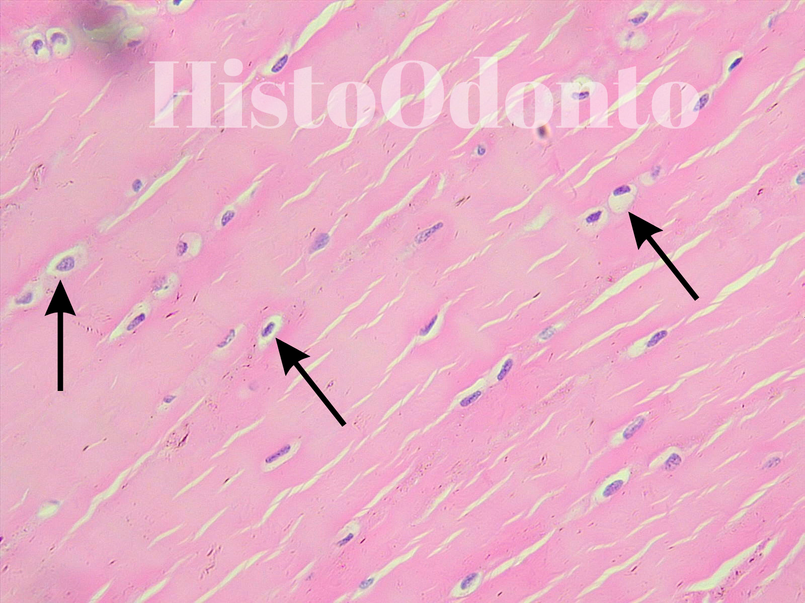 Tecido Epitelial de Revestimento - Epitélio Pavimentoso Estratificado Queratinizado
