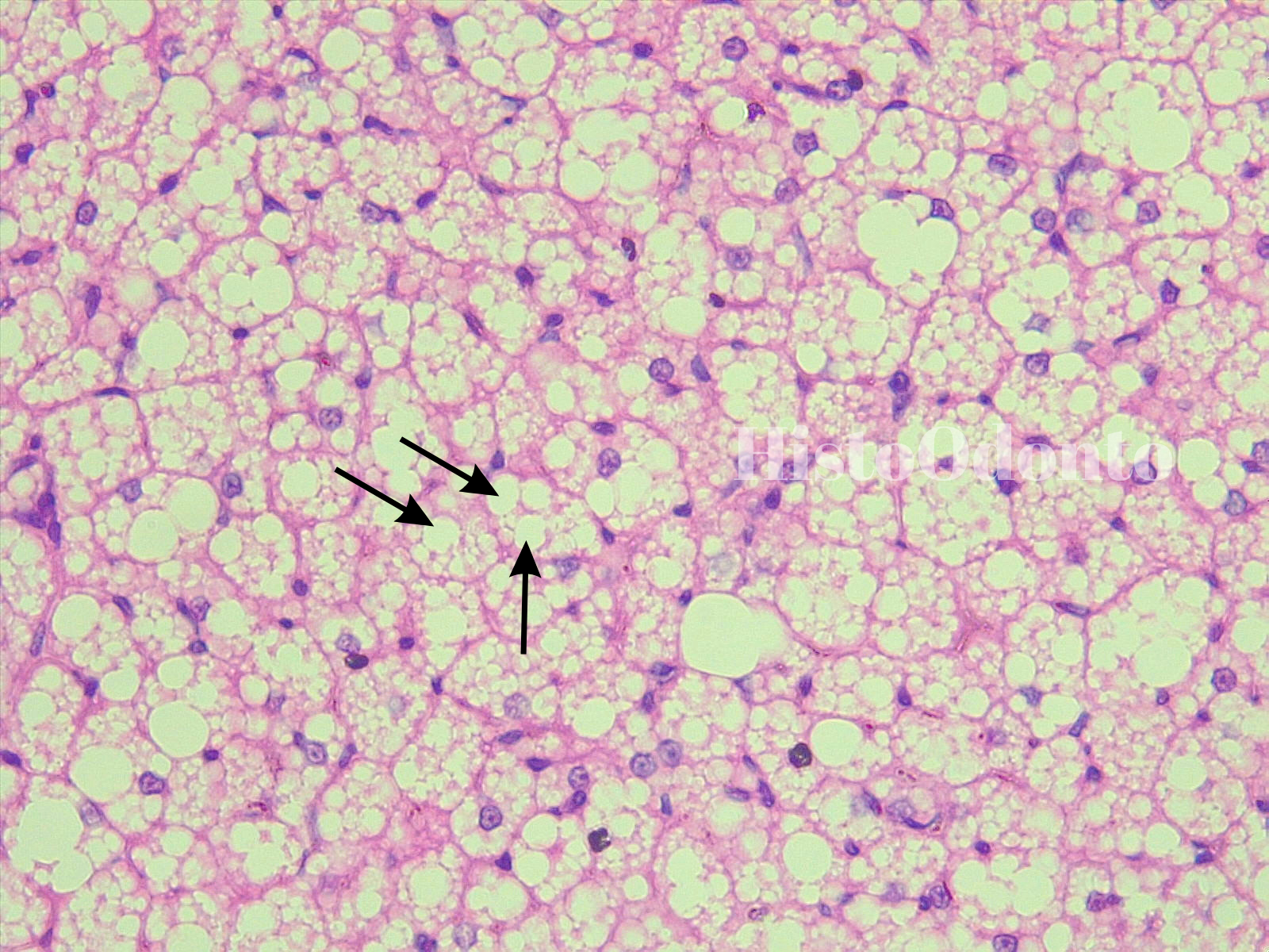 Tecido Epitelial de Revestimento - Epitélio Pavimentoso Estratificado Queratinizado