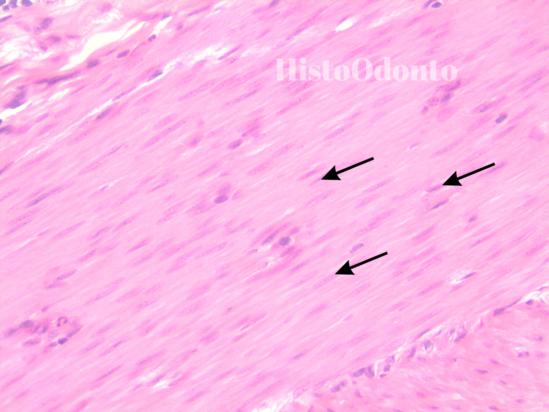 Tecido Epitelial de Revestimento - Epitélio Pavimentoso Estratificado Queratinizado