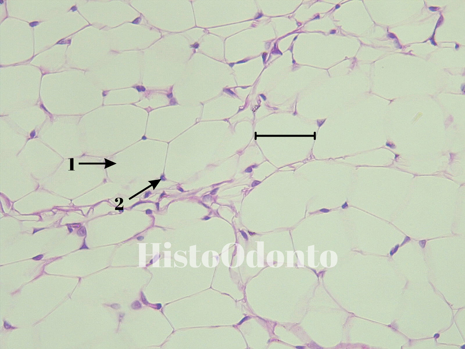 Tecido Epitelial de Revestimento - Epitélio Pavimentoso Estratificado Queratinizado